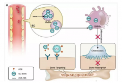 我國科學(xué)家發(fā)現(xiàn)血管內(nèi)皮細(xì)胞來源外泌體在骨代謝調(diào)控中發(fā)揮重要作用[圖]