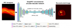 科學(xué)家們使用人工智能技術(shù)改進(jìn)傳統(tǒng)PET成像方法[圖]